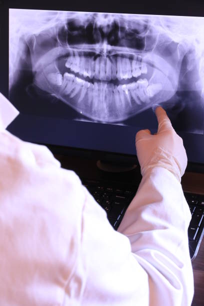 Best After-Hours Emergency Dentist in Mckinleyville, CA